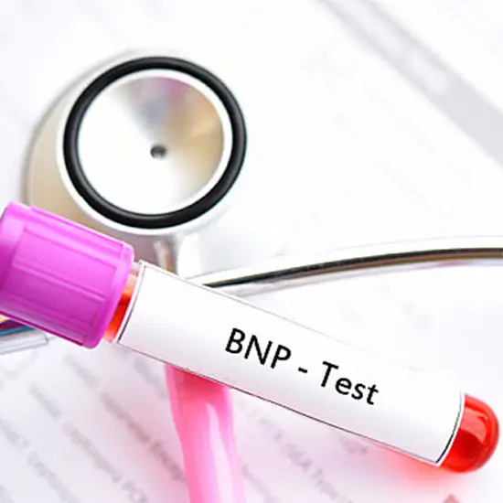 B-Type Natriuretic Peptide (BNP)